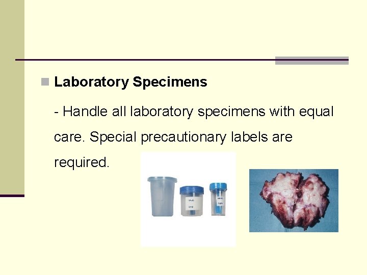 n Laboratory Specimens - Handle all laboratory specimens with equal care. Special precautionary labels