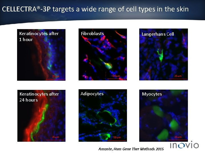 Electroporation mediated DNA vaccination results in improved immune