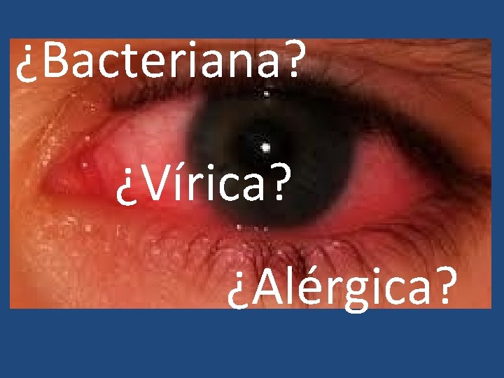 ¿Bacteriana? ¿Vírica? ¿Alérgica? 