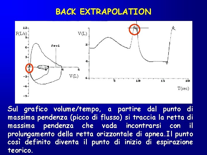 BACK EXTRAPOLATION F(L/s) V(L) T(sec) Sul grafico volume/tempo, a partire dal punto di massima