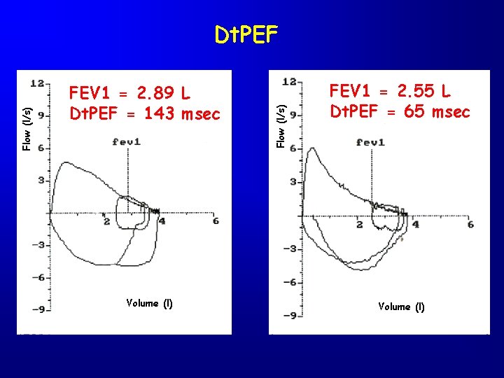 FEV 1 = 2. 89 L Dt. PEF = 143 msec Volume (l) Flow