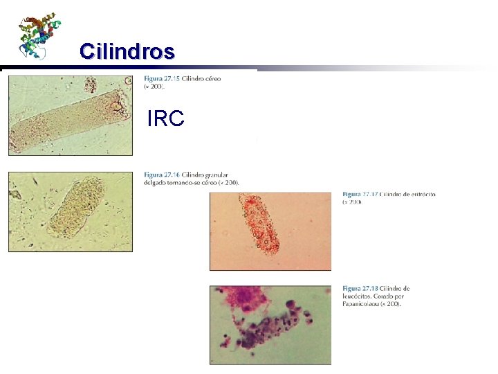 Cilindros IRC 