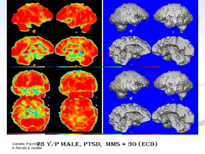 Geriatric Psychiatry: A Review & Update Geriatric Psychiatry: A Review & Update