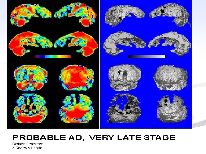 Geriatric Psychiatry: A Review & Update Geriatric Psychiatry: A Review & Update