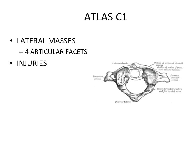 ATLAS C 1 • LATERAL MASSES – 4 ARTICULAR FACETS • INJURIES 