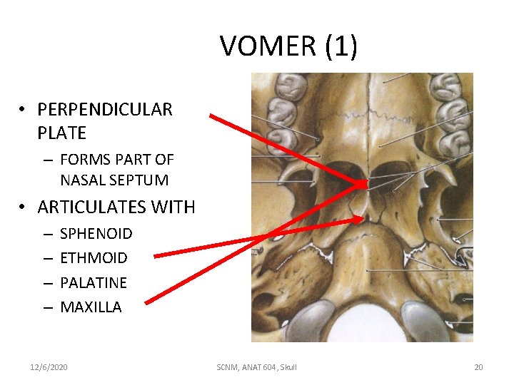 VOMER (1) • PERPENDICULAR PLATE – FORMS PART OF NASAL SEPTUM • ARTICULATES WITH