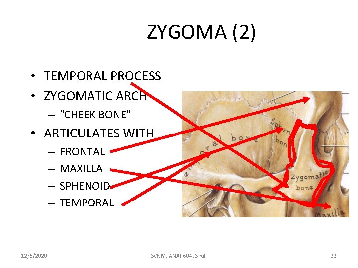 ZYGOMA (2) • TEMPORAL PROCESS • ZYGOMATIC ARCH – "CHEEK BONE" • ARTICULATES WITH