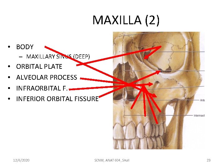 MAXILLA (2) • BODY – MAXILLARY SINUS (DEEP) • • ORBITAL PLATE ALVEOLAR PROCESS