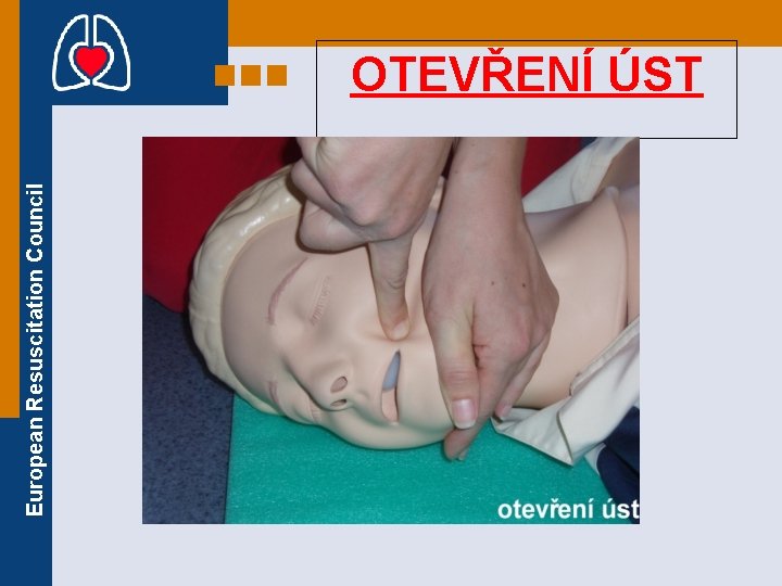 European Resuscitation Council OTEVŘENÍ ÚST 