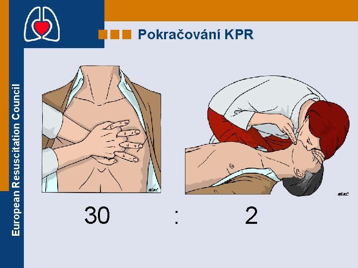 European Resuscitation Council Pokračování KPR 30 : 2 