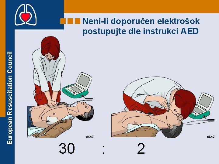 European Resuscitation Council Není-li doporučen elektrošok postupujte dle instrukcí AED 30 : 2 