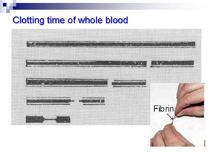 Clotting time of whole blood 