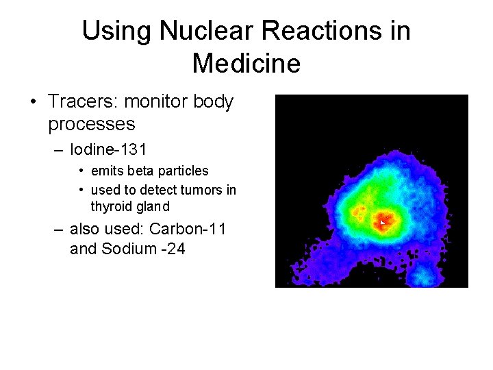 Using Nuclear Reactions in Medicine • Tracers: monitor body processes – Iodine-131 • emits