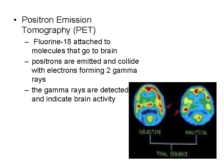  • Positron Emission Tomography (PET) – Fluorine-18 attached to molecules that go to