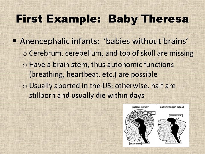 First Example: Baby Theresa § Anencephalic infants: ‘babies without brains’ o Cerebrum, cerebellum, and