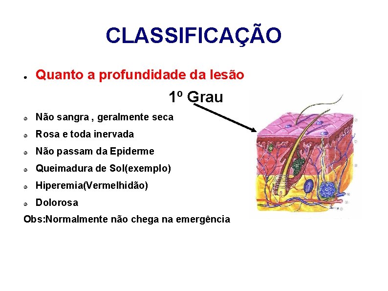 CLASSIFICAÇÃO ● Quanto a profundidade da lesão 1º Grau Não sangra , geralmente seca