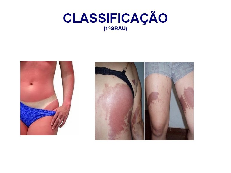 CLASSIFICAÇÃO (1ºGRAU) 