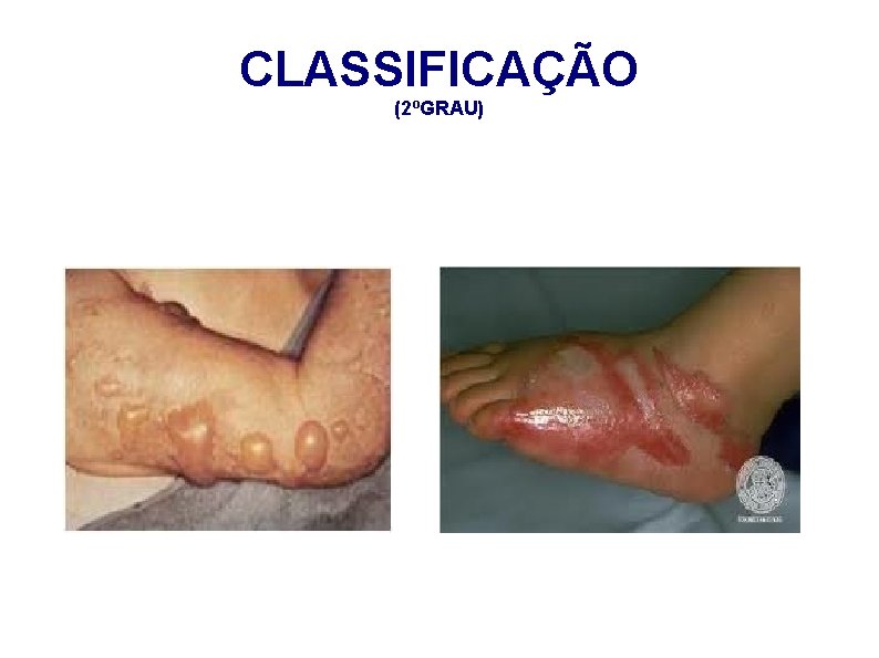CLASSIFICAÇÃO (2ºGRAU) 