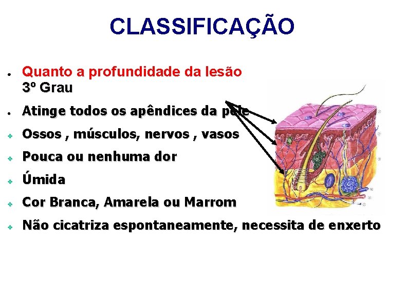 CLASSIFICAÇÃO ● Quanto a profundidade da lesão 3º Grau ● Atinge todos os apêndices