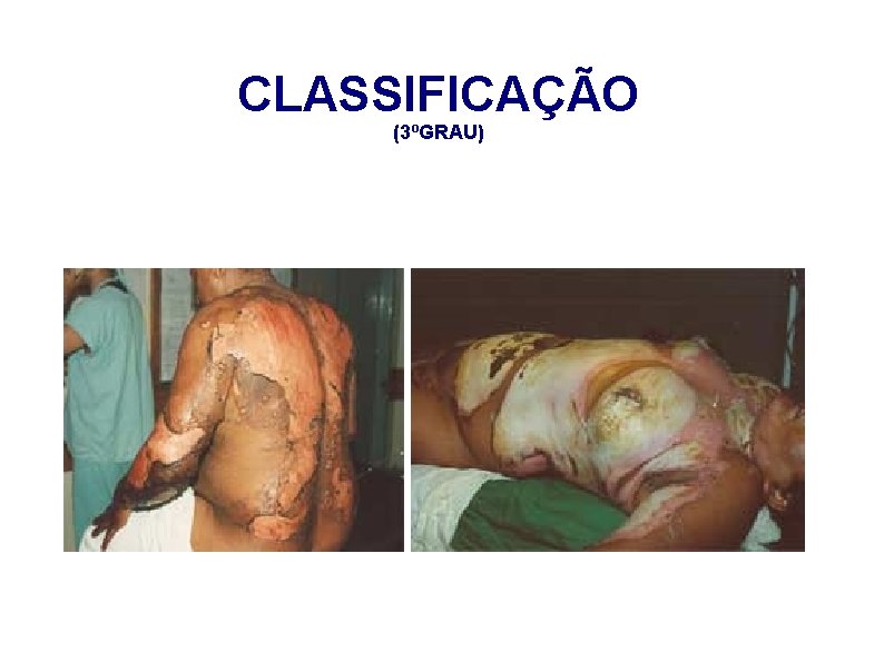 CLASSIFICAÇÃO (3ºGRAU) 