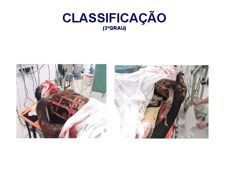 CLASSIFICAÇÃO (3ºGRAU) 