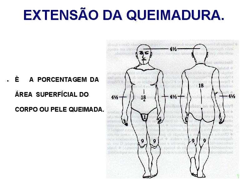 EXTENSÃO DA QUEIMADURA. ● È A PORCENTAGEM DA ÁREA SUPERFÍCIAL DO CORPO OU PELE