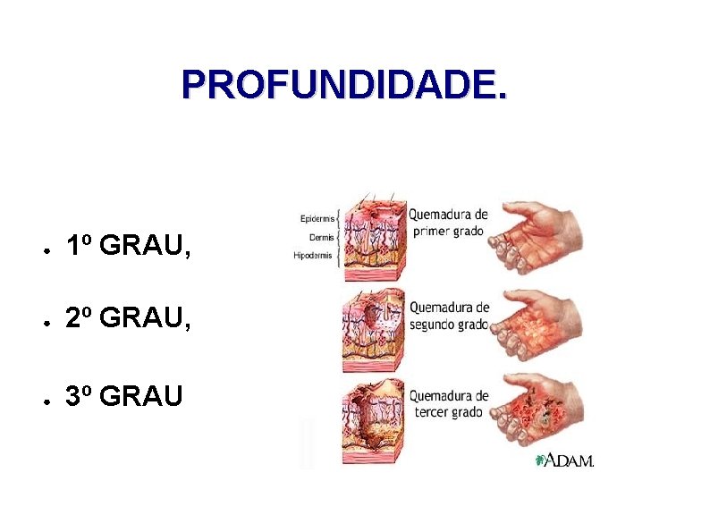 PROFUNDIDADE. ● 1º GRAU, ● 2º GRAU, ● 3º GRAU 
