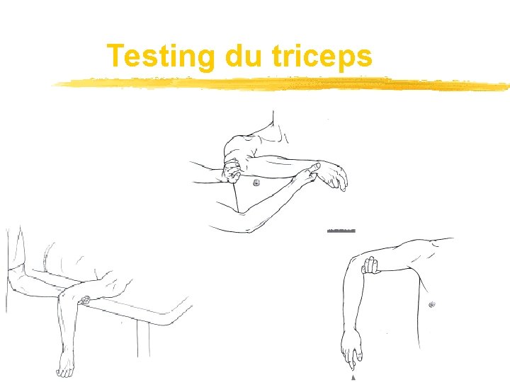 Testing du triceps 