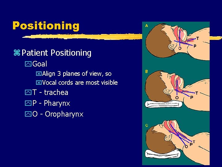 Positioning z Patient Positioning y. Goal x. Align 3 planes of view, so x.