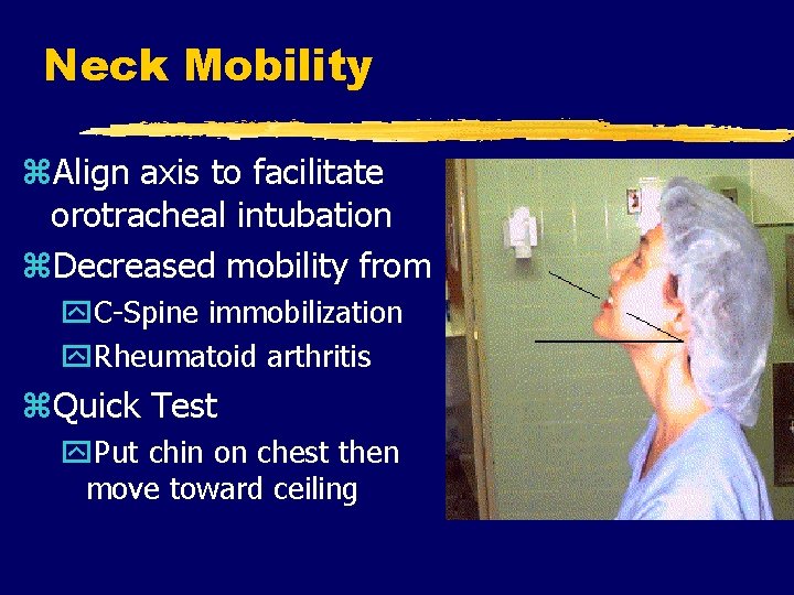 Neck Mobility z. Align axis to facilitate orotracheal intubation z. Decreased mobility from y.