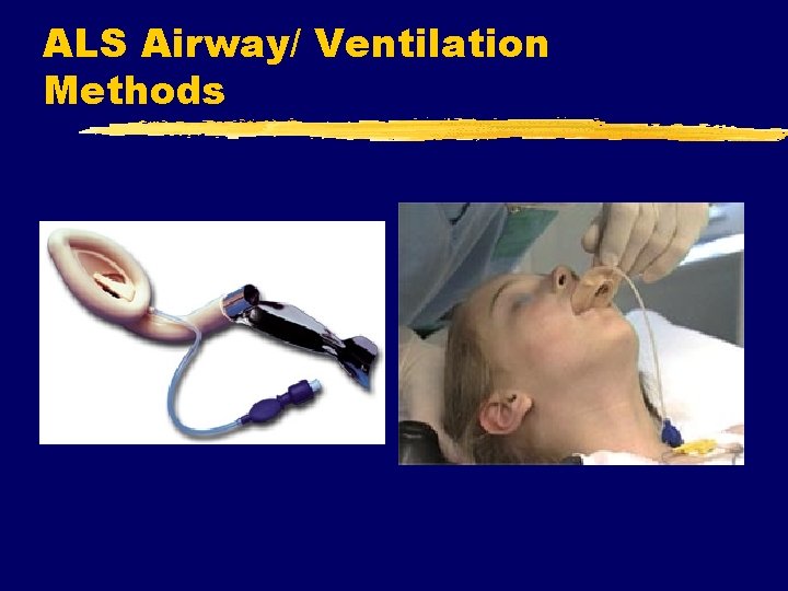 ALS Airway/ Ventilation Methods 