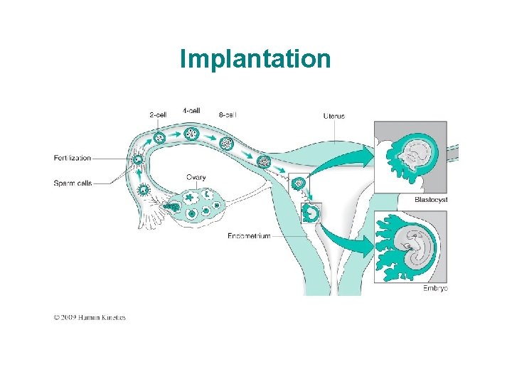 Implantation 