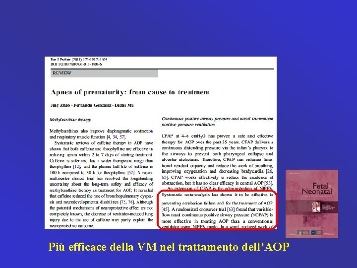 Più efficace della VM nel trattamento dell’AOP 