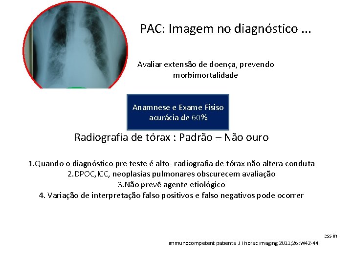 PAC: Imagem no diagnóstico. . . Avaliar extensão de doença, prevendo morbimortalidade Radiografia Anamnese