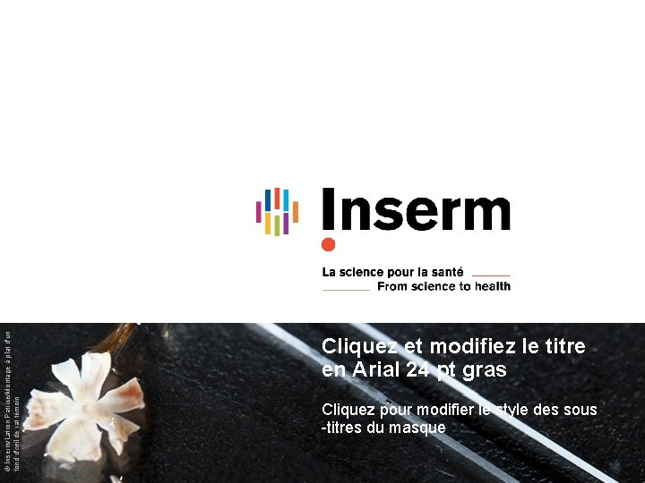 © Inserm/Latron Patrice/Montage à plat d'un fond d'œil de rat témoin Cliquez et modifiez