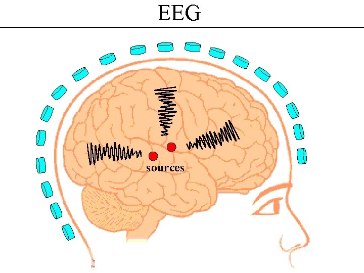 EEG sources 