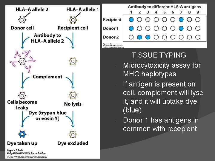 TISSUE TYPING Microcytoxicity assay for MHC haplotypes If antigen is present on cell, complement