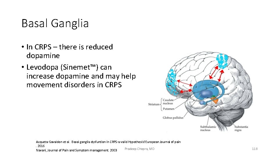 Basal Ganglia • In CRPS – there is reduced dopamine • Levodopa (Sinemet™) can