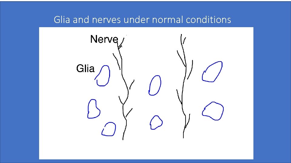 Glia and nerves under normal conditions Pradeep Chopra, MD 