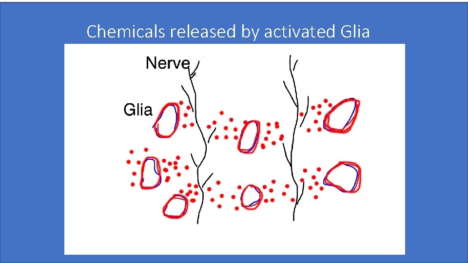 Chemicals released by activated Glia Pradeep Chopra, MD 