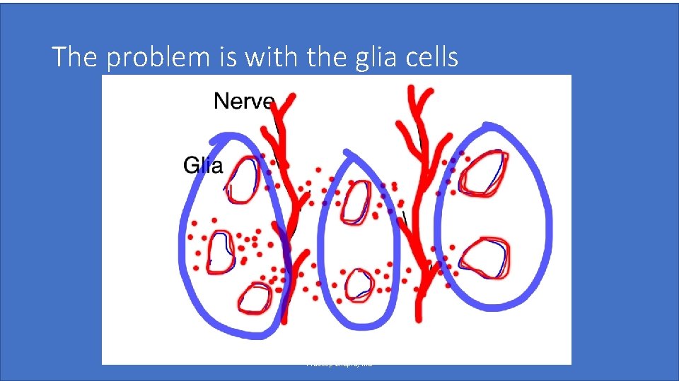 The problem is with the glia cells Pradeep Chopra, MD 