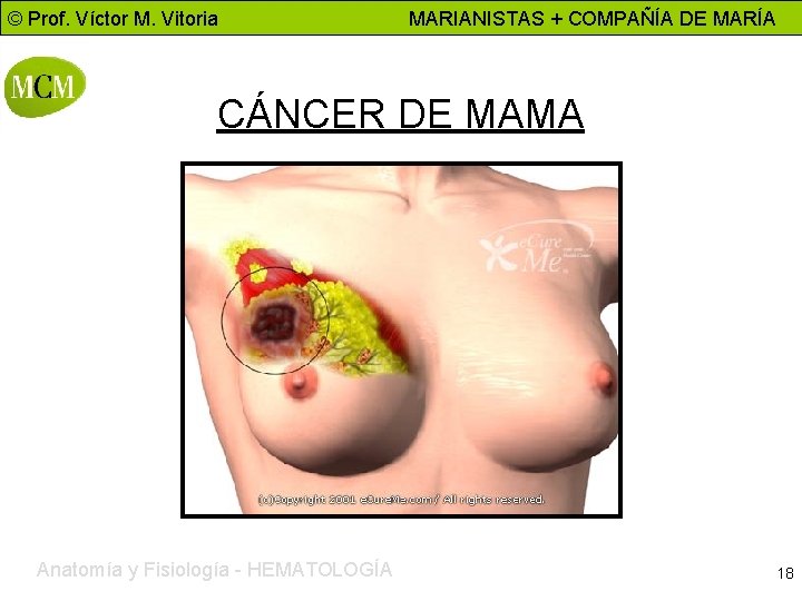 © Prof. Víctor M. Vitoria MARIANISTAS + COMPAÑÍA DE MARÍA CÁNCER DE MAMA Anatomía