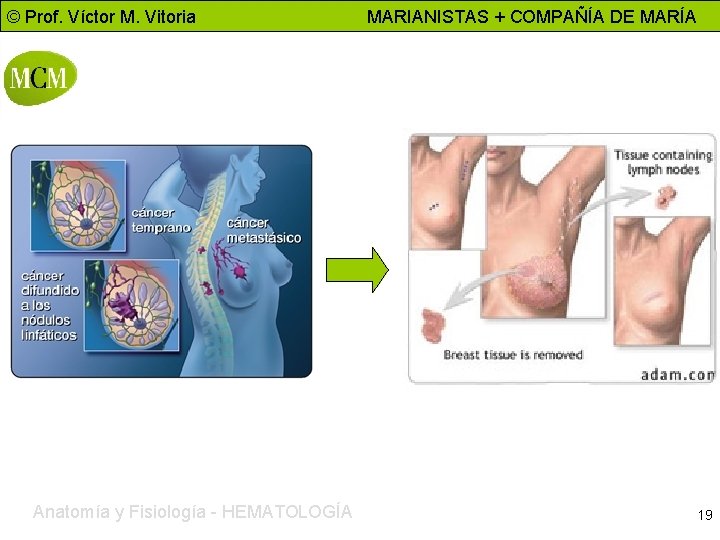 © Prof. Víctor M. Vitoria Anatomía y Fisiología - HEMATOLOGÍA MARIANISTAS + COMPAÑÍA DE