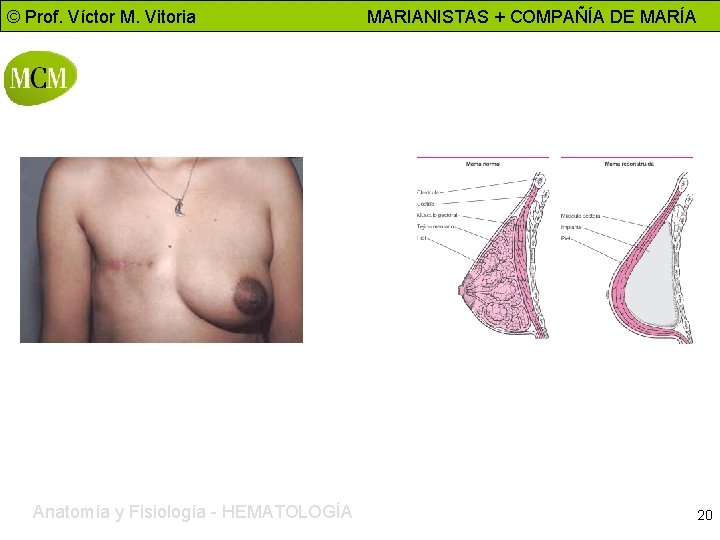 © Prof. Víctor M. Vitoria Anatomía y Fisiología - HEMATOLOGÍA MARIANISTAS + COMPAÑÍA DE