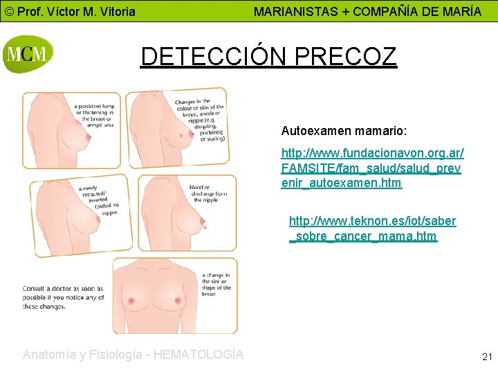 © Prof. Víctor M. Vitoria MARIANISTAS + COMPAÑÍA DE MARÍA DETECCIÓN PRECOZ Autoexamen mamario: