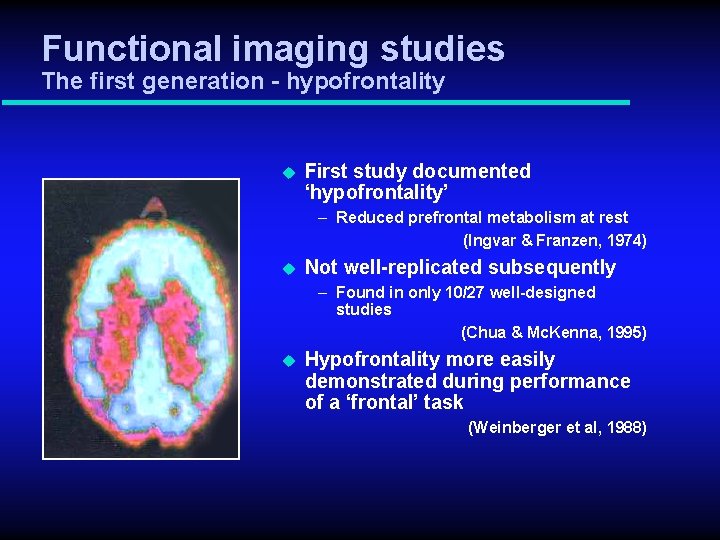Esquizofrenia Cerebro Y Neuroimagen Lo Que Todava No
