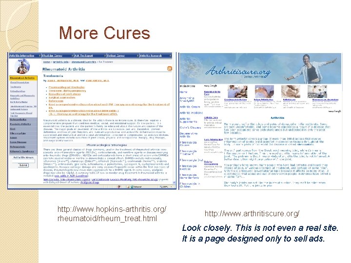 More Cures http: //www. hopkins-arthritis. org/ rheumatoid/rheum_treat. html http: //www. arthritiscure. org/ Look closely.