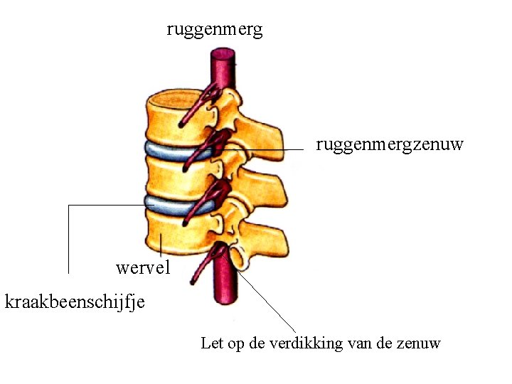 ruggenmergzenuw wervel kraakbeenschijfje Let op de verdikking van de zenuw 