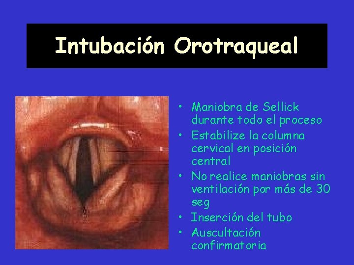 Intubación Orotraqueal • Maniobra de Sellick durante todo el proceso • Estabilize la columna