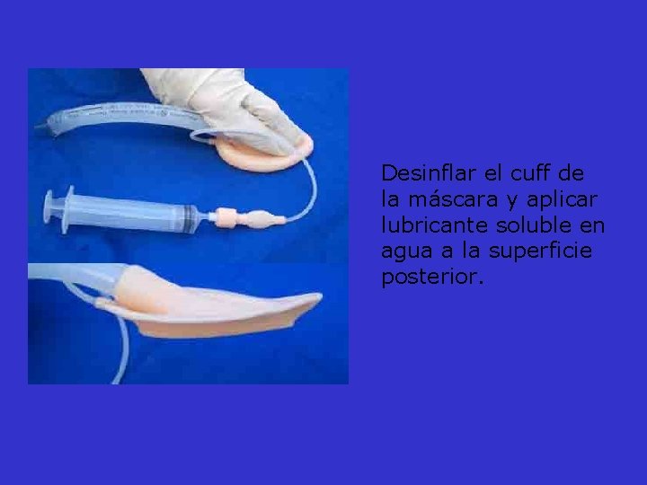 Desinflar el cuff de la máscara y aplicar lubricante soluble en agua a la